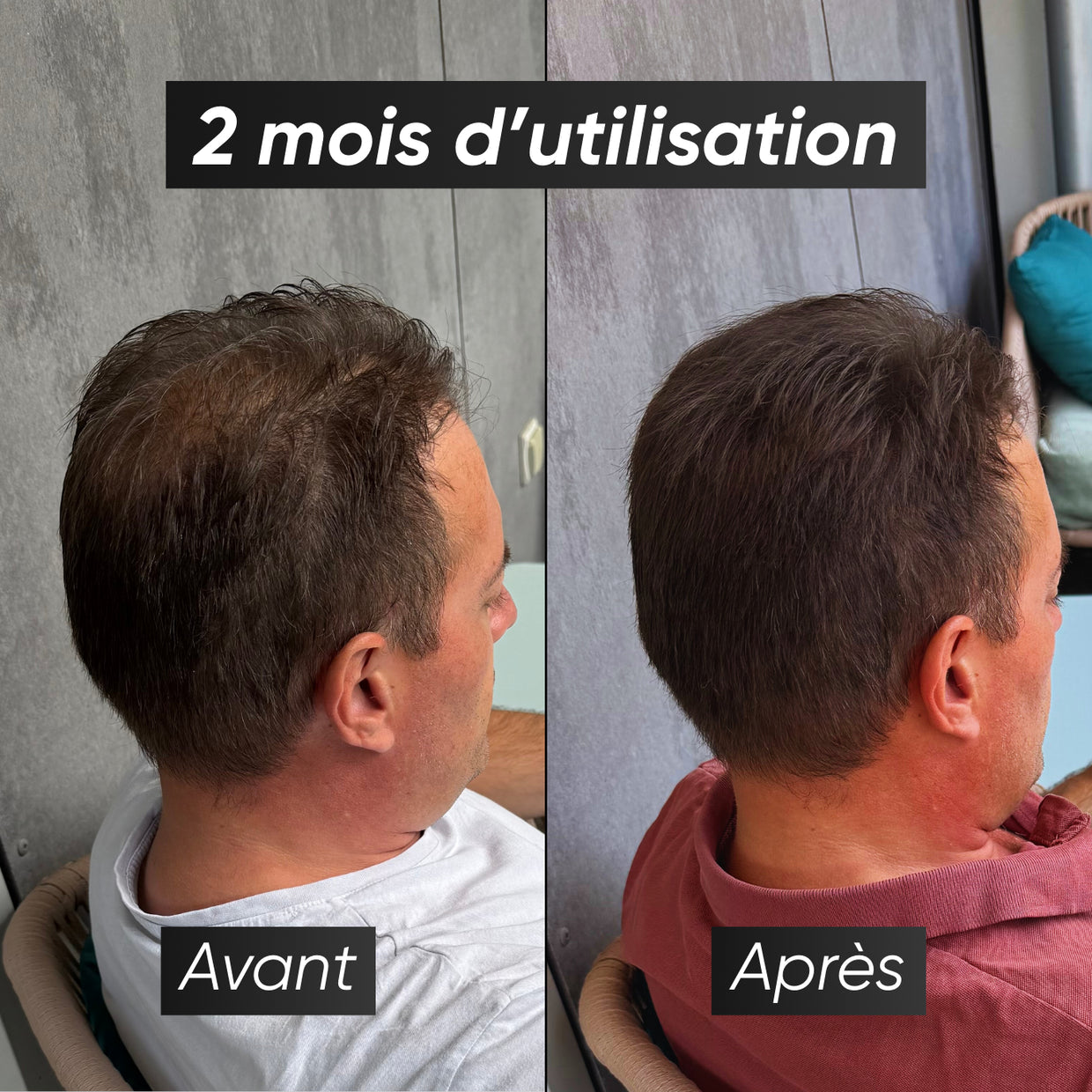 Sérum repousse et anti chute de cheveux